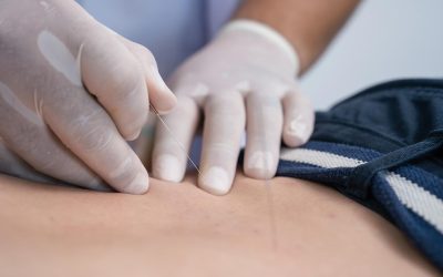 Akupunkturbehandling: Effektiv smertelindring og helbredelse