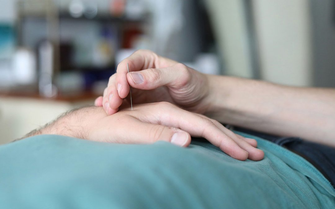 Akupunktur i Vestjylland: En effektiv behandlingsmetode
